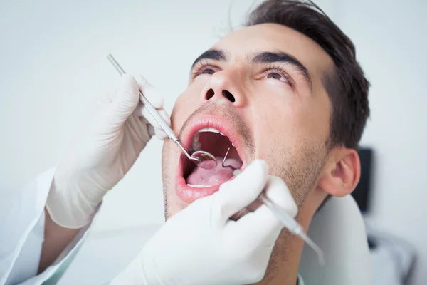 Muž s jeho zuby zkoumala — Stock fotografie