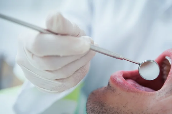 Nahaufnahme eines Mannes, der seine Zähne untersuchen lässt — Stockfoto