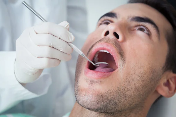 Homem com os dentes examinados — Fotografia de Stock