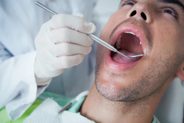 Close-up de homem ter seus dentes examinados — Fotografia de Stock