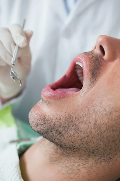 Close up van man met zijn tanden onderzocht — Stockfoto