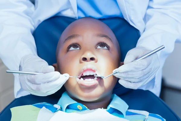 Close up de menino ter seus dentes examinados — Fotografia de Stock