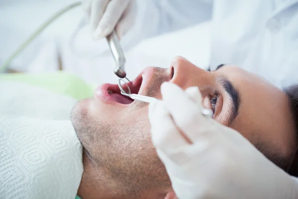 Primer plano del hombre examinándose los dientes — Foto de Stock