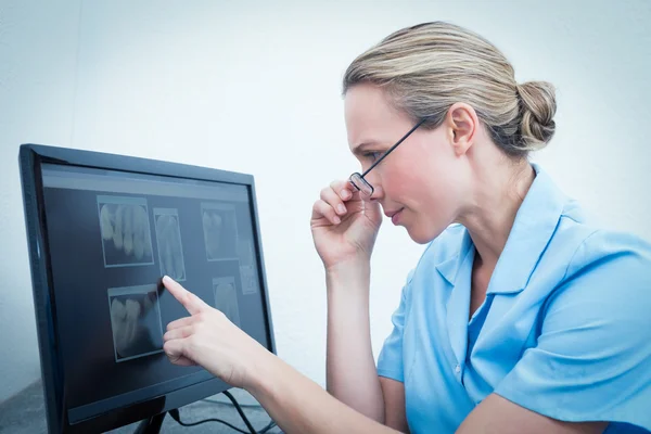 Θηλυκό οδοντίατρος εξετάσουμε το x-ray στον υπολογιστή — Φωτογραφία Αρχείου