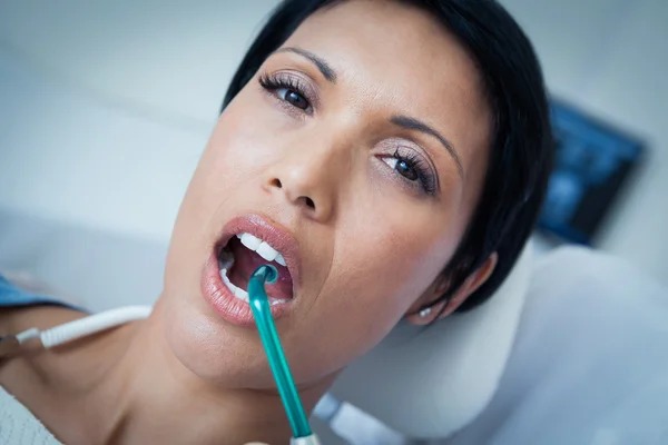 Zamknij się z kobieta o jej zęby — Zdjęcie stockowe