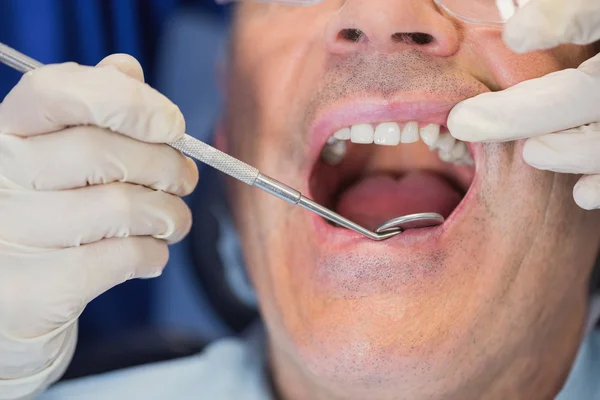 Pacienta otevřená ústa a zubař zkoumání — Stock fotografie