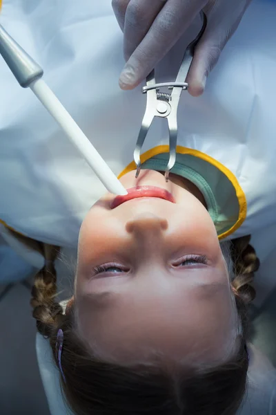 Närbild på tjej som har hennes tänder undersöks — Stockfoto