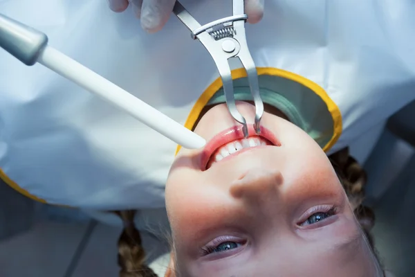 Nahaufnahme eines Mädchens, das seine Zähne untersuchen lässt — Stockfoto