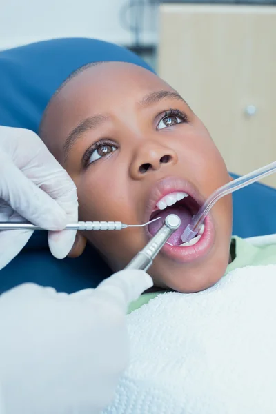 Menino com os dentes examinados pelo dentista — Fotografia de Stock