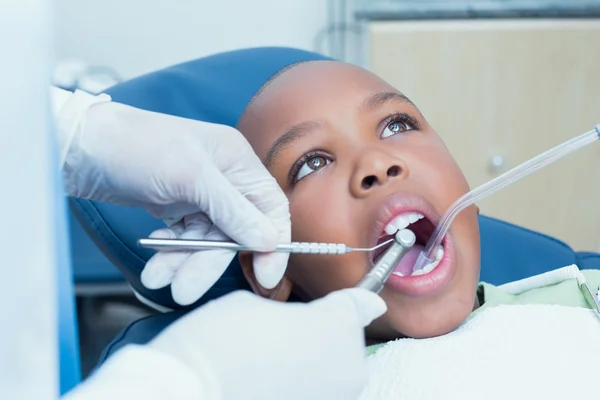 Menino com os dentes examinados pelo dentista — Fotografia de Stock