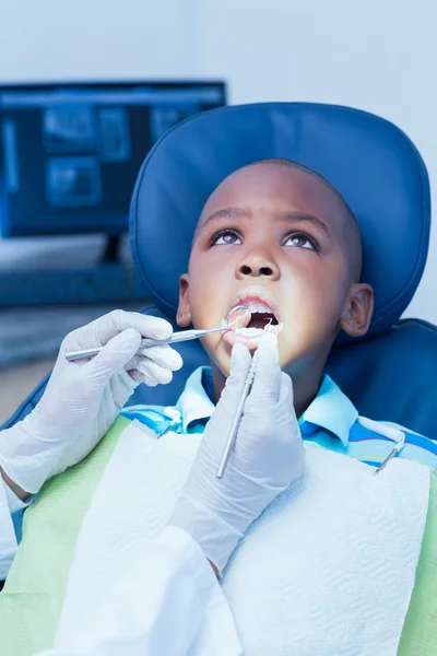 Nahaufnahme eines Jungen, der seine Zähne untersuchen lässt — Stockfoto