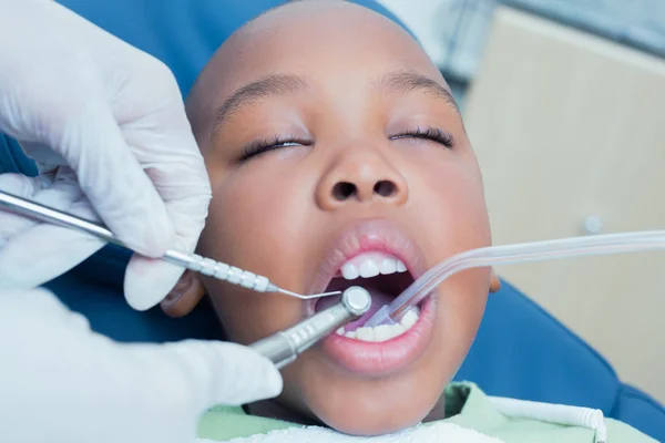 Chlapec s jeho zuby vyšetřit zubař — Stock fotografie
