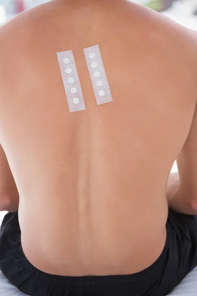 Patiënt met huid test in zijn rug — Stockfoto