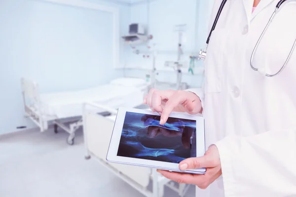 Composite image of doctor looking at xray on tablet — Stock Photo, Image