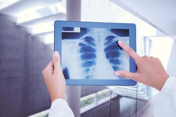 Composite image of doctor looking at xray on tablet — Stock Photo, Image