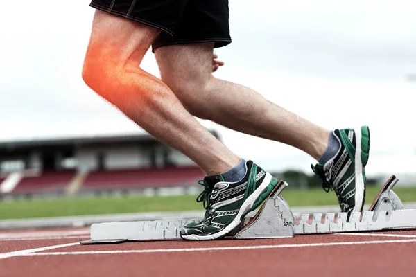 Podświetlony kolana człowieka o do wyścigu — Zdjęcie stockowe