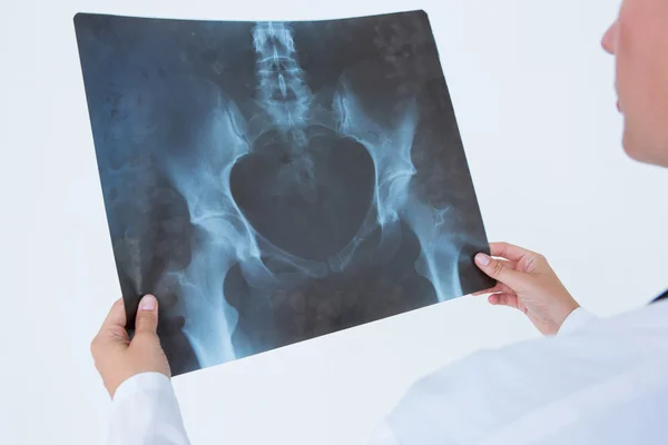 Concentrez-vous médecin regardant X-Rays — Photo