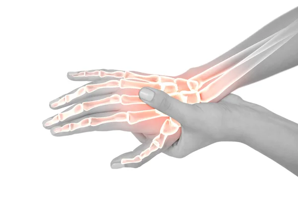 Podświetlony kości kobiety z bólem ręki — Zdjęcie stockowe
