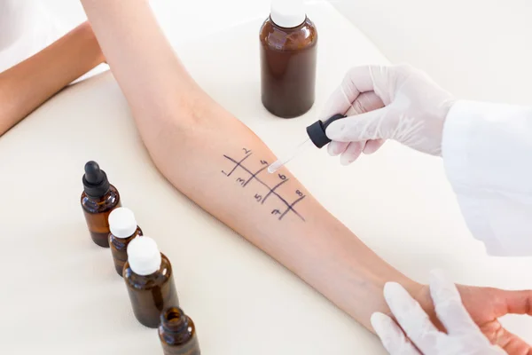 Doctor doing skin prick test at her patient — Stock Photo, Image