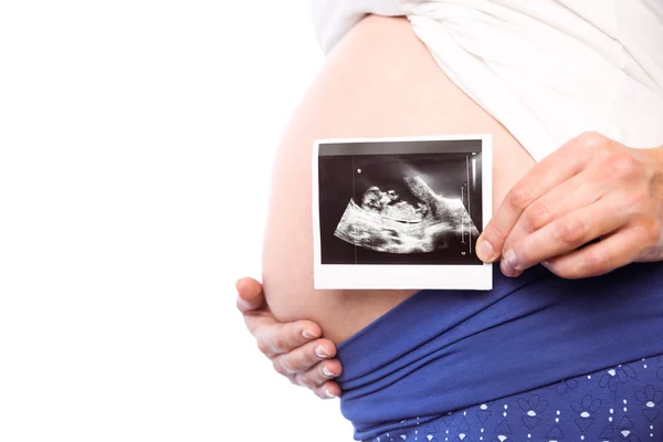 Pregnant woman showing ultrasound scans — Stock Photo, Image