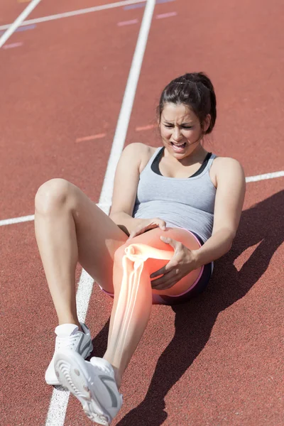 Highlighted bones of injured runner — Stock Image Highlighted bones of injured runner Stock Picture