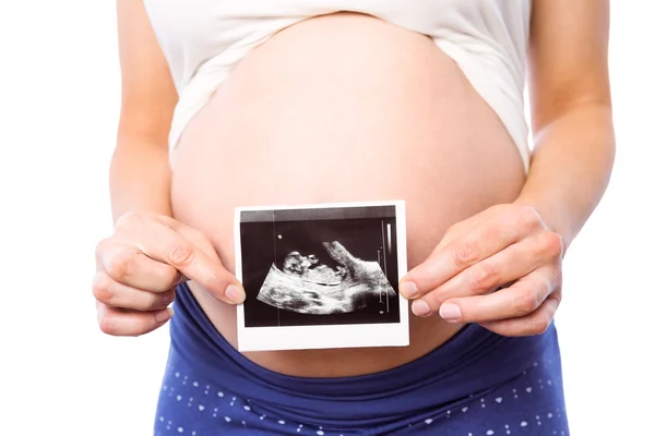 Pregnant woman showing ultrasound scans — Stock Photo, Image