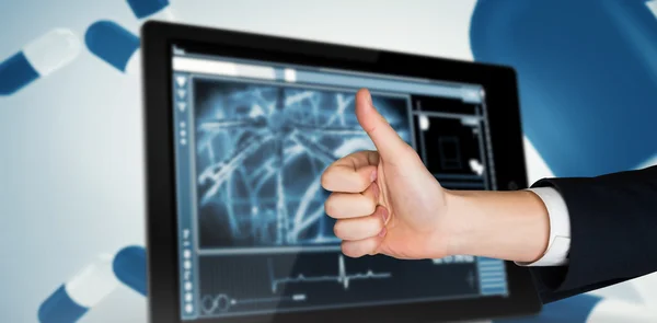 Composite image of hand showing thumbs up — Stock Photo, Image