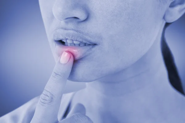 Mujer señalando su labio —  Fotos de Stock