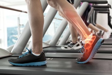 Highlighted bones of man on treadmill clipart