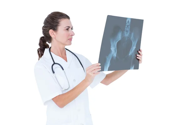 Koncentrat lekarz patrząc na zdjęcia rentgenowskie — Zdjęcie stockowe