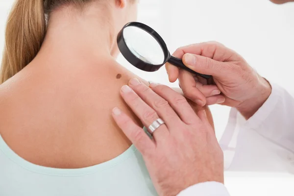 Doctor examining brown spot — Stock Photo, Image