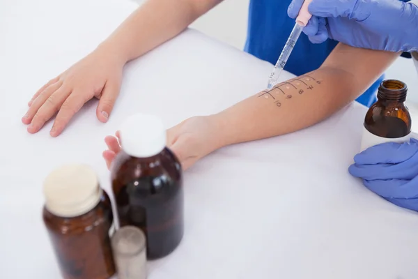 Médico realizando teste cutâneo picada — Fotografia de Stock