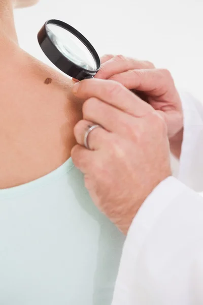 Doctor examining brown spot — Stock Photo, Image