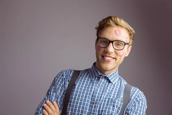 Hipster covered in kisses — Stock Photo, Image