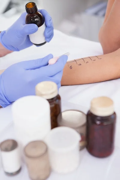 Doctor carrying out prick test — Stock Photo, Image