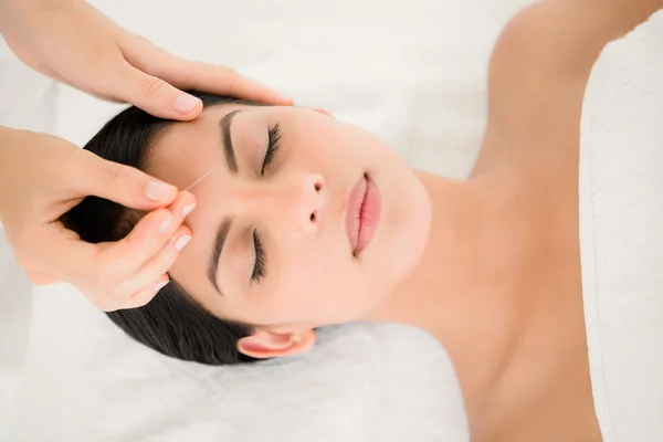 Mulher em uma terapia de acupuntura no spa — Fotografia de Stock