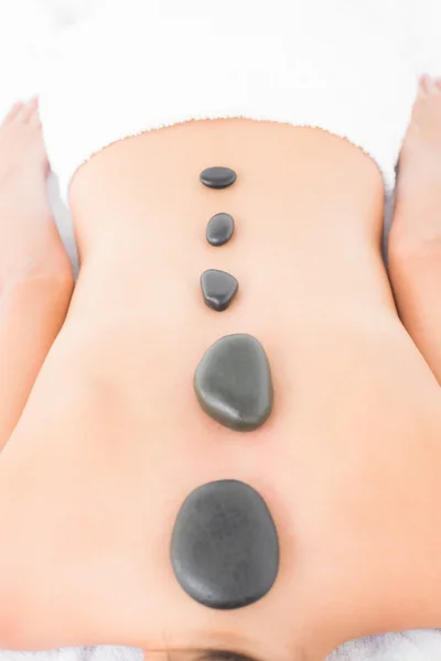 Woman enjoying hot stone massage — Stock Photo, Image