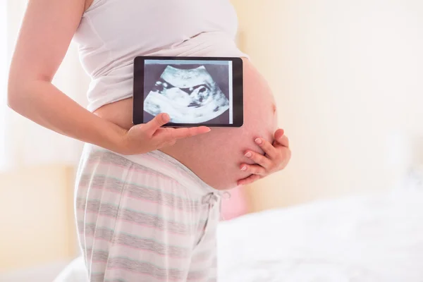 Gravid kvinna visar ultraljudsundersökningar — Stockfoto