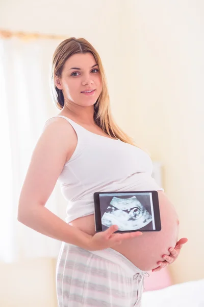 Mulher grávida mostrando ultra-som — Fotografia de Stock