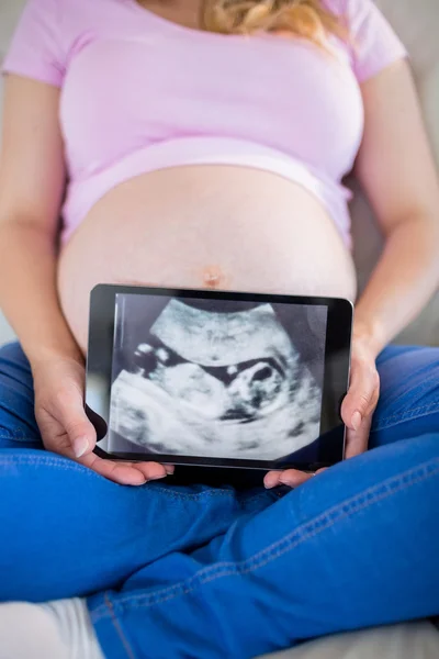 Pregnant woman showing ultrasound scans — Stock Photo, Image