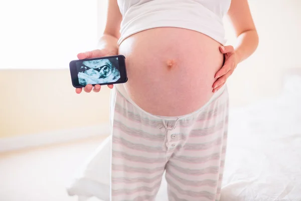 Kobieta w ciąży Wyświetlono USG — Zdjęcie stockowe