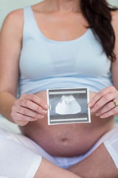 Gravid kvinna visar ultraljudsundersökning — Stockfoto