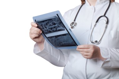 X-ışını resim beyaz bir arka plan üzerinde elinde doktorla. Seçin