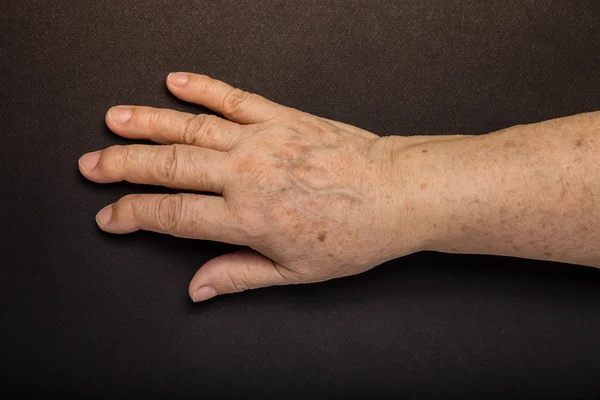 Hände einer älteren Frau auf schwarzem Hintergrund. gemildert — Stockfoto