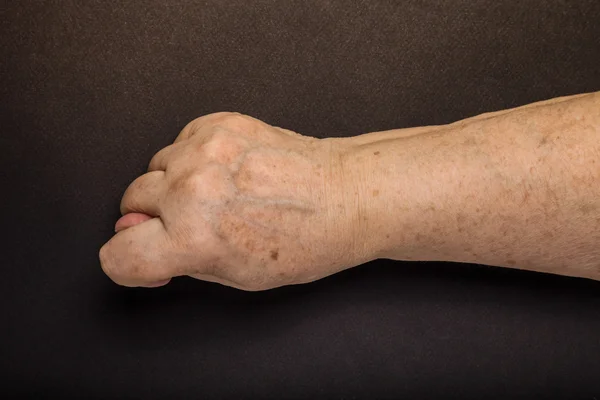 Hände einer älteren Frau auf schwarzem Hintergrund. gemildert — Stockfoto