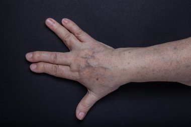 Yaşlı kadın siyah arka plan üzerine eller