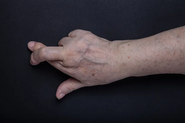 Händerna på äldre kvinna på svart bakgrund — Stockfoto
