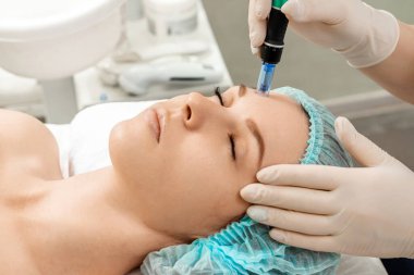 Deriyi temizlemek için tıbbi, kozmetik prosedürler, gözenekleri yüzdeki özel bir aletle temizlemek. Cilt bakımı, kozmetik prosedürleri.