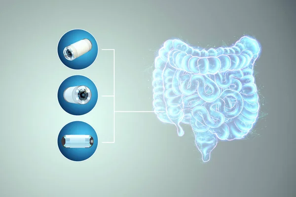 Proyección Holográfica Gammagrafía Intestinal Cápsula Endoscópica Con Videocámara Pequeña Concepto —  Fotos de Stock