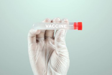 Eldivenli bir doktorun elinde COVID-19 aşısı olan bir test tüpü var. Tıbbi araştırma, yakın plan.